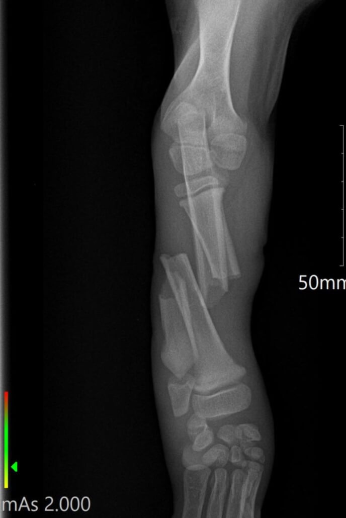 hurt-puppy1-688x1030-1